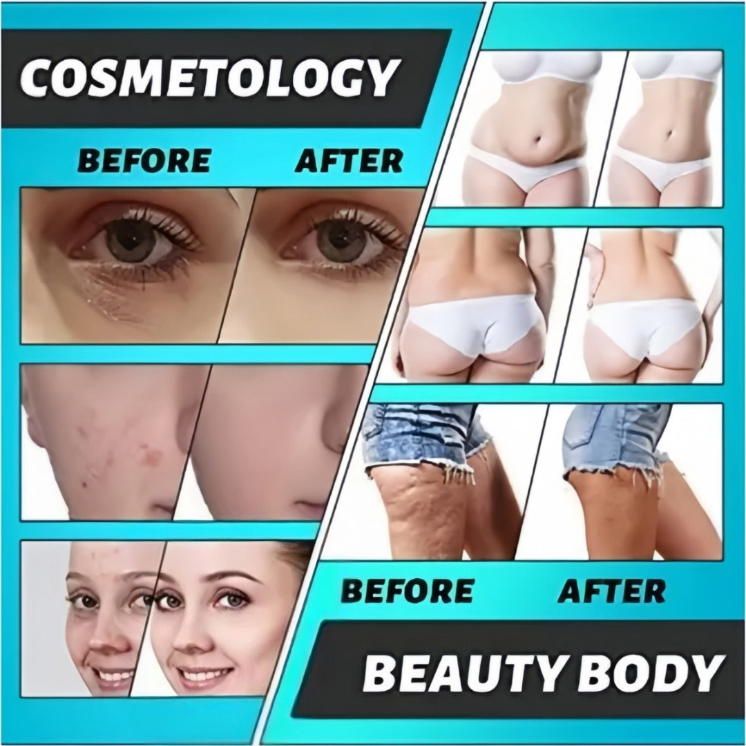 Maquina Cavitacion 6 En 1 Radiofrecuencia + lipolaser + vacuum Ultrasonido