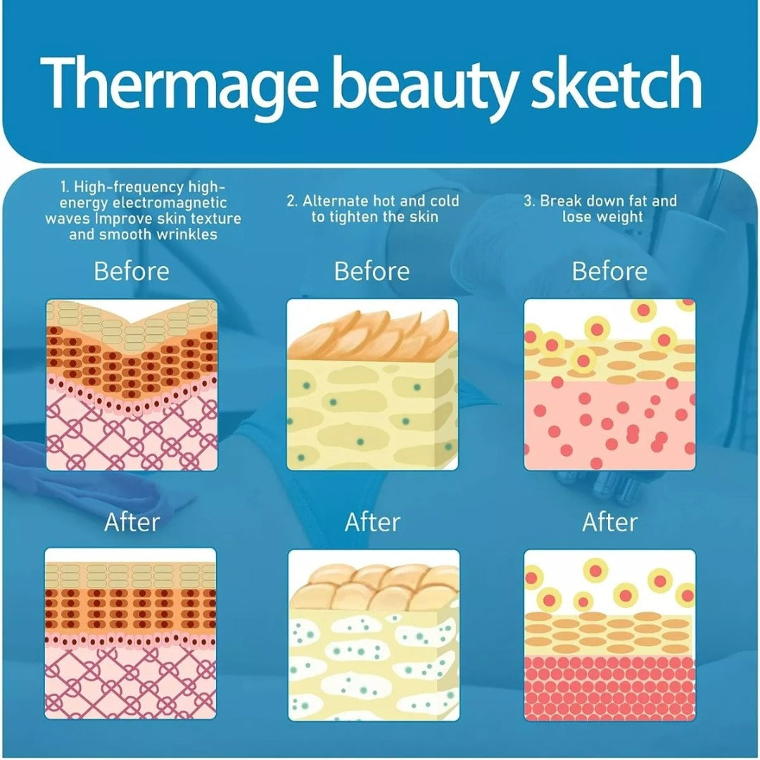 Maquina Radiofrecuencia Cavitacion 40k Ultrasonido 3 En 1