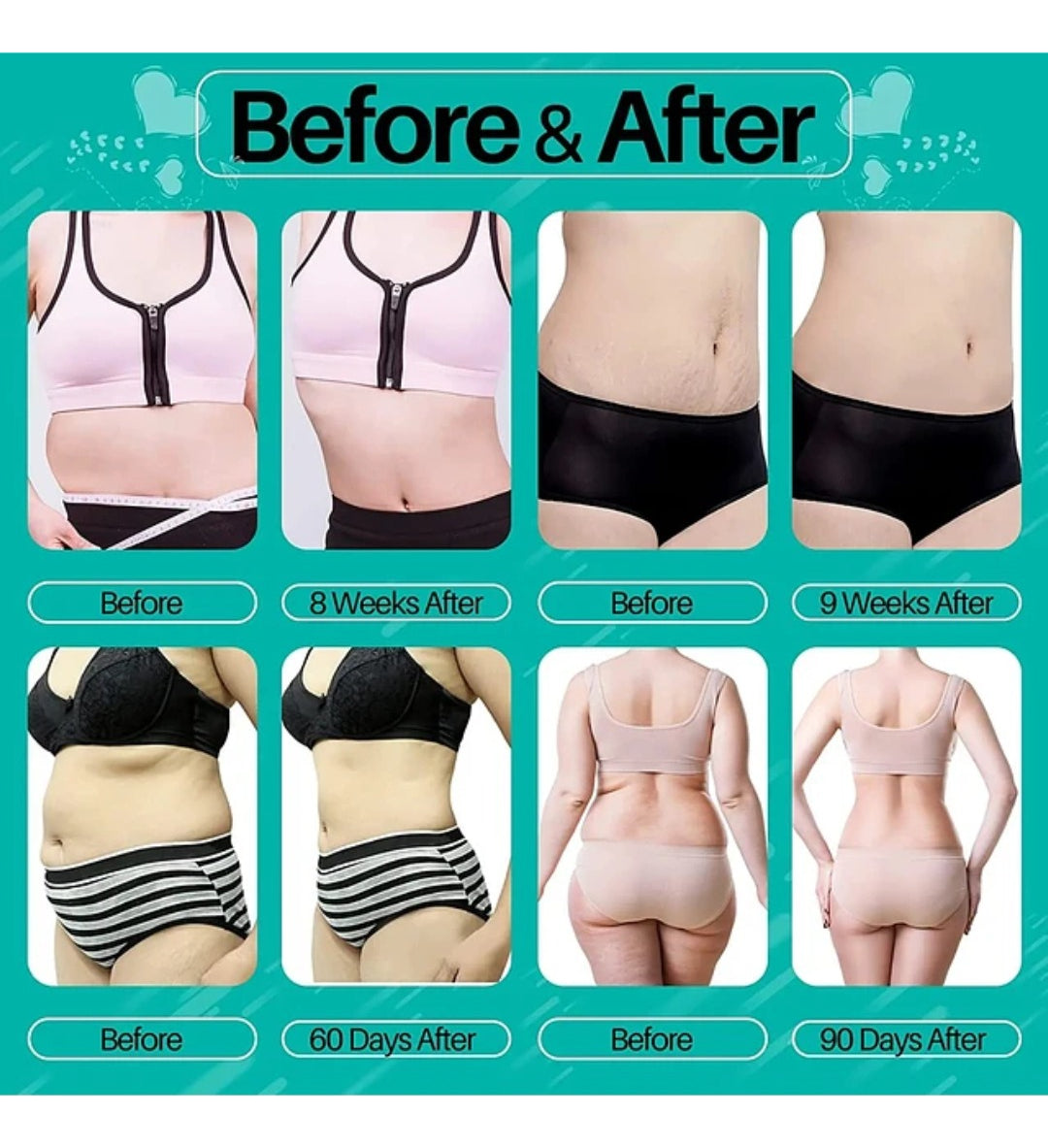 Maquina Cavitacion 6 En 1 Radiofrecuencia + lipolaser + vacuum Ultrasonido